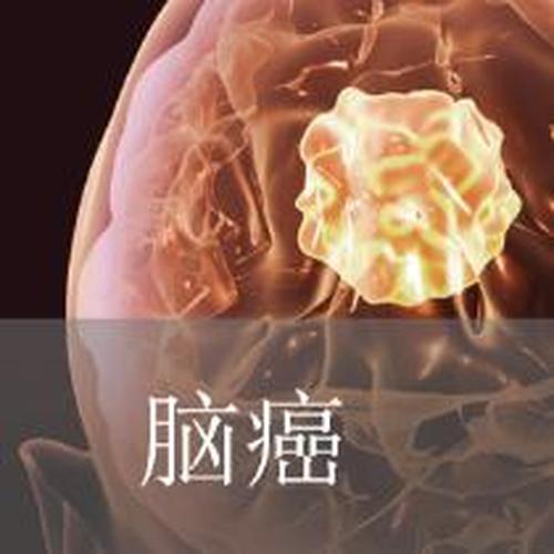 北京天健醫院特聘專家李佩文、朱世杰講腦癌