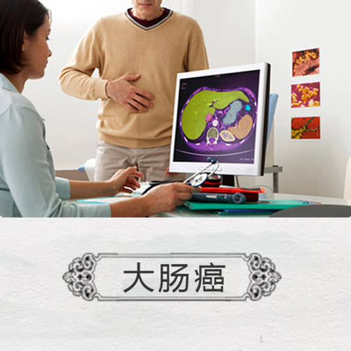 北京天健醫院特聘專家張文彭、朱世杰講大腸癌