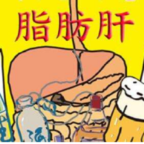 遠離“富貴病”遠離脂肪肝