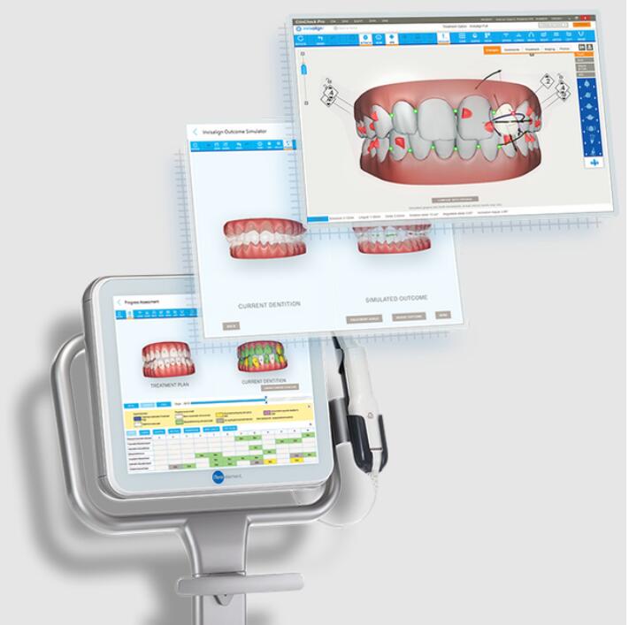 iTero扫描仪体验者招募报名开始啦