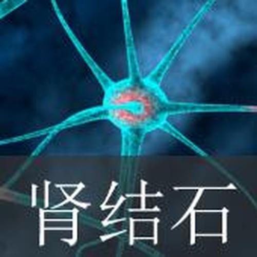 北京天健醫(yī)院特聘專家張雪亮講腎結(jié)石