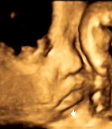 周兴平宝宝0岁第二次影集